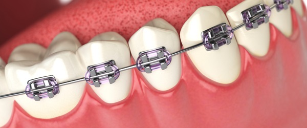 Orthodontics